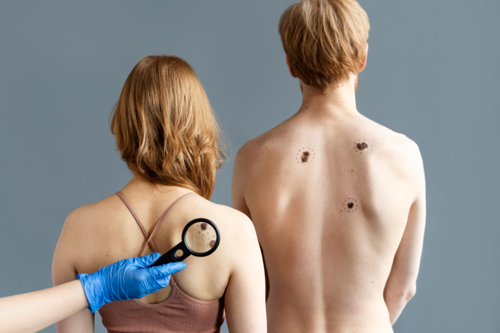 Un uomo e una donna di spalle durante un controllo dermatologico dei nei con lente d’ingrandimento